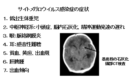 ウイルス サイト メガロ