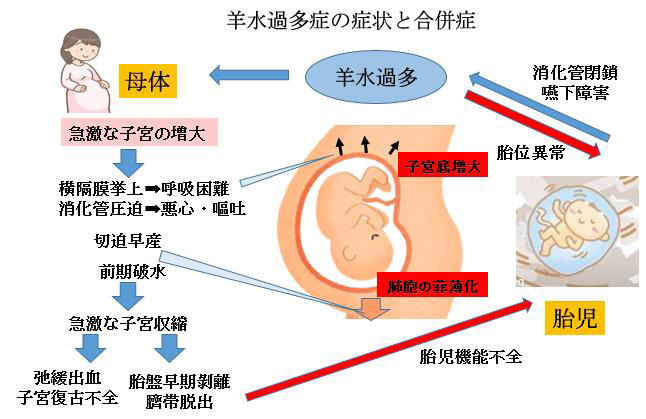 連載ばぁばみちこコラム 第三十八回 赤ちゃんに問題となる妊娠合併症 羊水の異常 ここすまネット