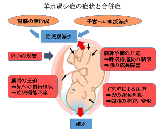 連載ばぁばみちこコラム 第三十八回 赤ちゃんに問題となる妊娠合併症 羊水の異常 ここすまネット