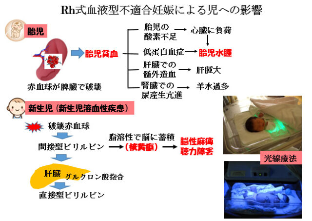 不規則抗体