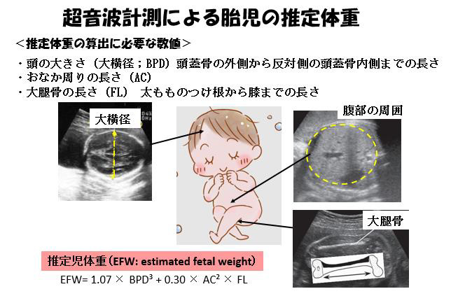 連載ばぁばみちこコラム第四十二回 赤ちゃんに問題となる妊娠合併症